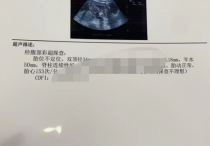 和龙市妇幼保健计划生育服务中心B超单,孕6周彩色超声报告单